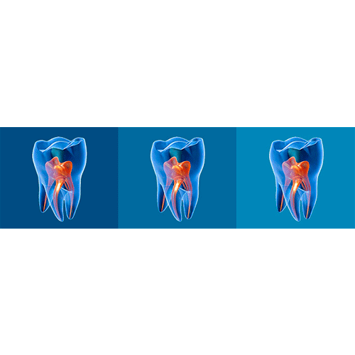 nervio y vasos sanguíneos alojados dentro del diente