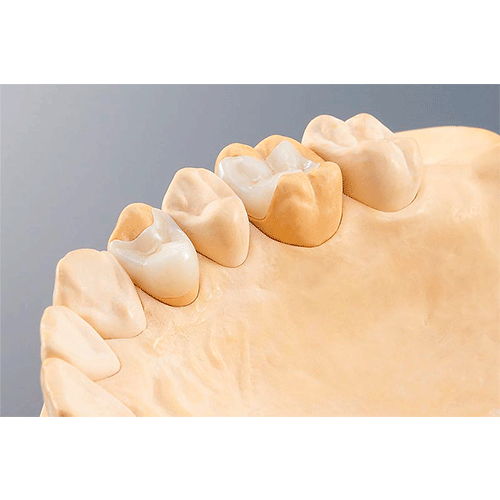 molde dental